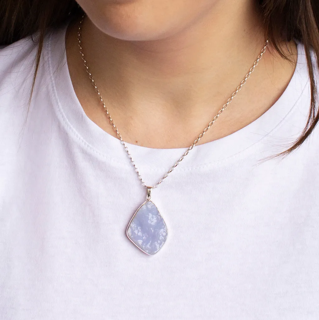 Botyroidal Blue Chalcedony Necklace