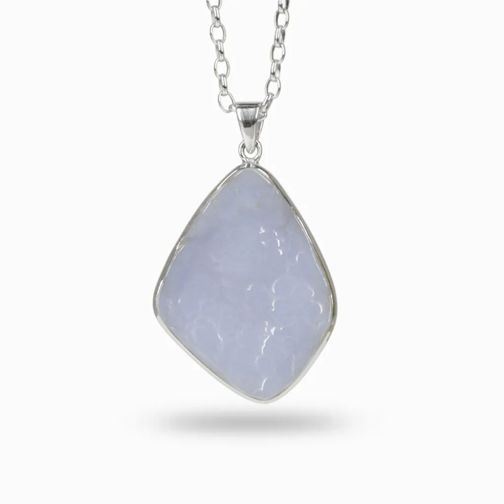 Botyroidal Blue Chalcedony Necklace